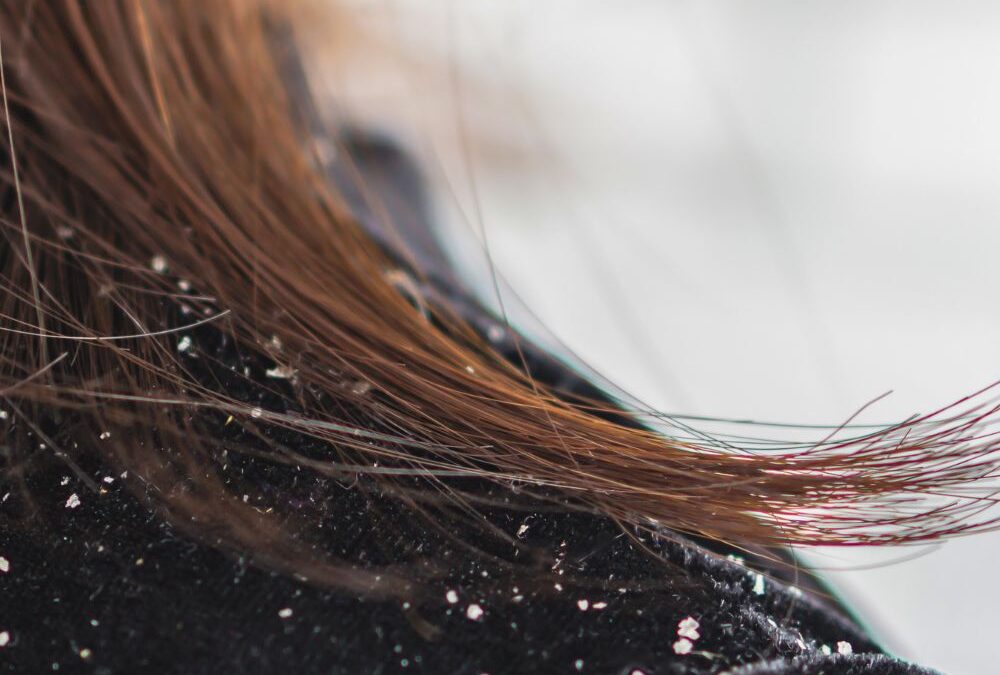 Organic Hair Oils for Dry and Itchy Scalp