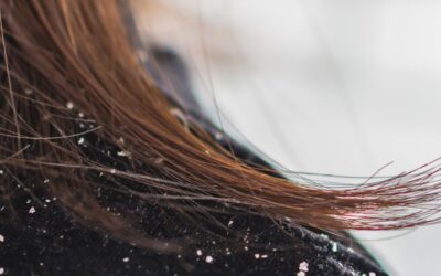 Top 10 Organic Hair Oils for Dry Scalp and Itchy Skin (2025)